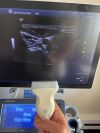 GE Logiq S8 XDClear Ultrasound System