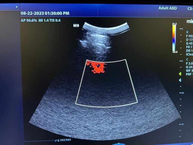 MINDRAY C5-1 Ultrasound Transducer