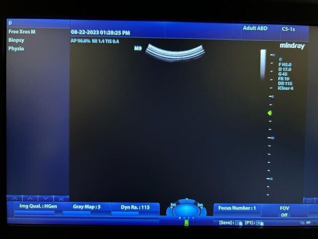 MINDRAY C5-1 Ultrasound Transducer