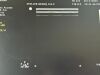 PHILIPS MEDICAL L15-7io Refurbished  Linear Probe for Sparq