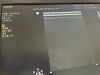 PHILIPS MEDICAL L15-7io Ultrasound Transducer