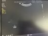 PHILIPS MEDICAL C6-2 Ultrasound Transducer
