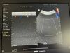 PHILIPS MEDICAL C6-2 Ultrasound Transducer