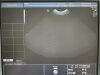 GE IC5-9-D Ultrasound Transducer