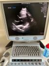 ZONARE P4-1C Ultrasound Transducer