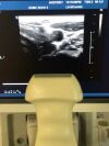 PHILIPS IE33 Ultrasound System
