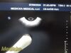 PHILIPS C8-4V Convex Array P/N 453561497492 Endocavity Ultrasound Transducer