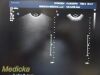 PHILIPS C8-4V Convex Array P/N 453561497492 Endocavity Ultrasound Transducer