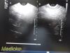 PHILIPS C8-4V Convex Array P/N 453561497492 Endocavity Ultrasound Transducer