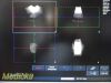 PHILIPS C8-4V Convex Array P/N 453561497492 Endocavity Ultrasound Transducer