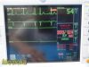 GE Dash 3000 Series , (Masimo SpO2) W/ NEW Patient Leads ~Patient Monitor