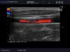 ALOKA UST-579T Ultrasound Transducer