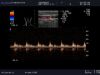 ALOKA UST-579T Ultrasound Transducer