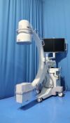 EDAP TMS i-move Lithotripter