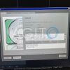 SIEMENS MAGNETOM Avanto 1.5T MRI Scanner