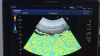 TOSHIBA PVT-382BT Ultrasound Transducer