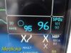 GE 2011 Baxter Drager Med D-Vapor S-2000 Ref M35500-25 Desflurane Vaporizer