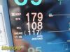 NIHON KOHDEN 2006  Model BSM-2354A-S-M Bedside Monitor