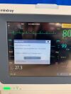 MINDRAY iMEC 10 YOM: 2013 Monitor