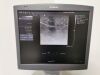 SIEMENS Acuson S2000 + 9L4 + 4C1