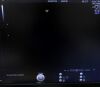 GE Voluson E8 Ultrasound - OB / GYN