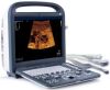 SONOSCAPE S2 Ultrasound Machine