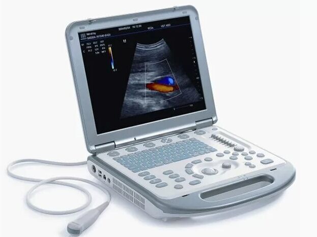 MINDRAY M5 Ultrasound Machine