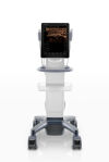 MINDRAY TE-5 Ultrasound - Shared Service