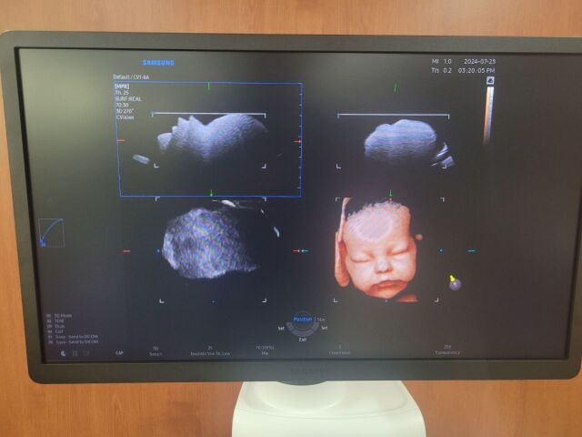 SAMSUNG-MEDISON RS85 Prestige. Ultrasound - Shared Service