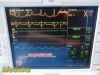 GE Dash 3000 Series, (Nellcor SpO2) W/ NEW Patient Leads ~  Patient Monitor