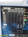 GE Dash 3000 Series, (Nellcor SpO2) W/ NEW Patient Leads ~  Patient Monitor