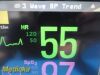 PHILIPS Intellivue MP50 Anesthesia , MMS CO IBP Print Modules Leads~ Anesthesia Monitor