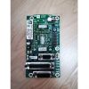 PHILIPS 451213340491 PHILIPS Chest X-Ray Parts P/N 451213340491 Chest X-Ray