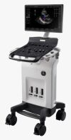 GE Versana Ultrasound Machine Ultrasound General