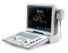 MINDRAY DP-50 Ultrasound Machine Ultrasound General