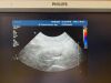 PHILIPS C8-5 CURVED ARRAY ABDOMINAL TRANSDUCER PROBE REF 453561190822 30 DAYS WARRANTY Ultrasound Transducer