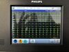 PHILIPS Page Writer TC30 ECG unit