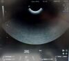 GE VOLUSON I Ultrasound - OB / GYN