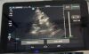 FUJIFILM Sonosite iViz Portable Ultrasound