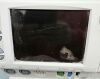 GE MEDICAL SYSTEMS 259CX-A FETAL MONITOR
