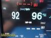 NIHON KOHDEN 2018  Lifescope BSM 6000 Monitor