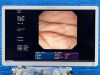 OLYMPUS Scope GIF-UCT260 Ultrasound Gastroscope Endoscope
