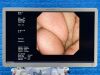 OLYMPUS Scope GIF-UCT260 Ultrasound Gastroscope Endoscope