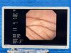 OLYMPUS Scope GIF-UCT260 Ultrasound Gastroscope Endoscope