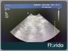 PHILIPS X6-1 XMATRIX PHASED ARRAY TRANSDUCER PROBE REF 453561247501 30 DAYS WARRANTY Ultrasound Transducer