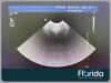 PHILIPS X6-1 XMATRIX PHASED ARRAY TRANSDUCER PROBE REF 453561247501 30 DAYS WARRANTY Ultrasound Transducer