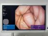 OLYMPUS GIF-H190N Scope Endoscope