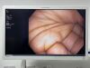 OLYMPUS GIF-H190N Scope Endoscope