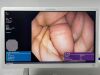 OLYMPUS GIF-H190N Scope Endoscope