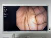 OLYMPUS GIF-H190N Scope Endoscope